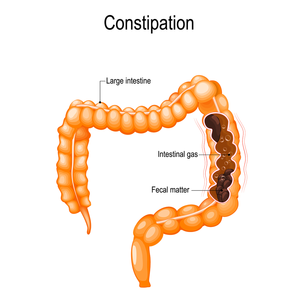 Constipation treatment near me