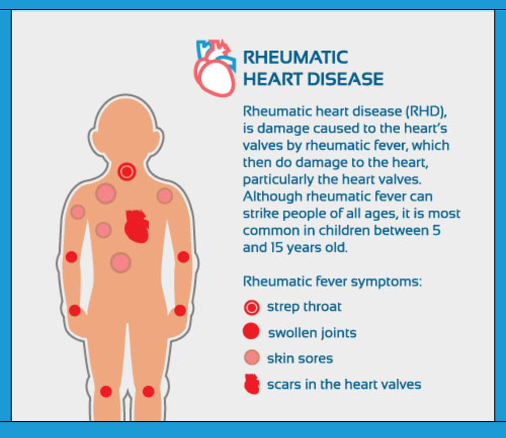 rheumatic heart diseases